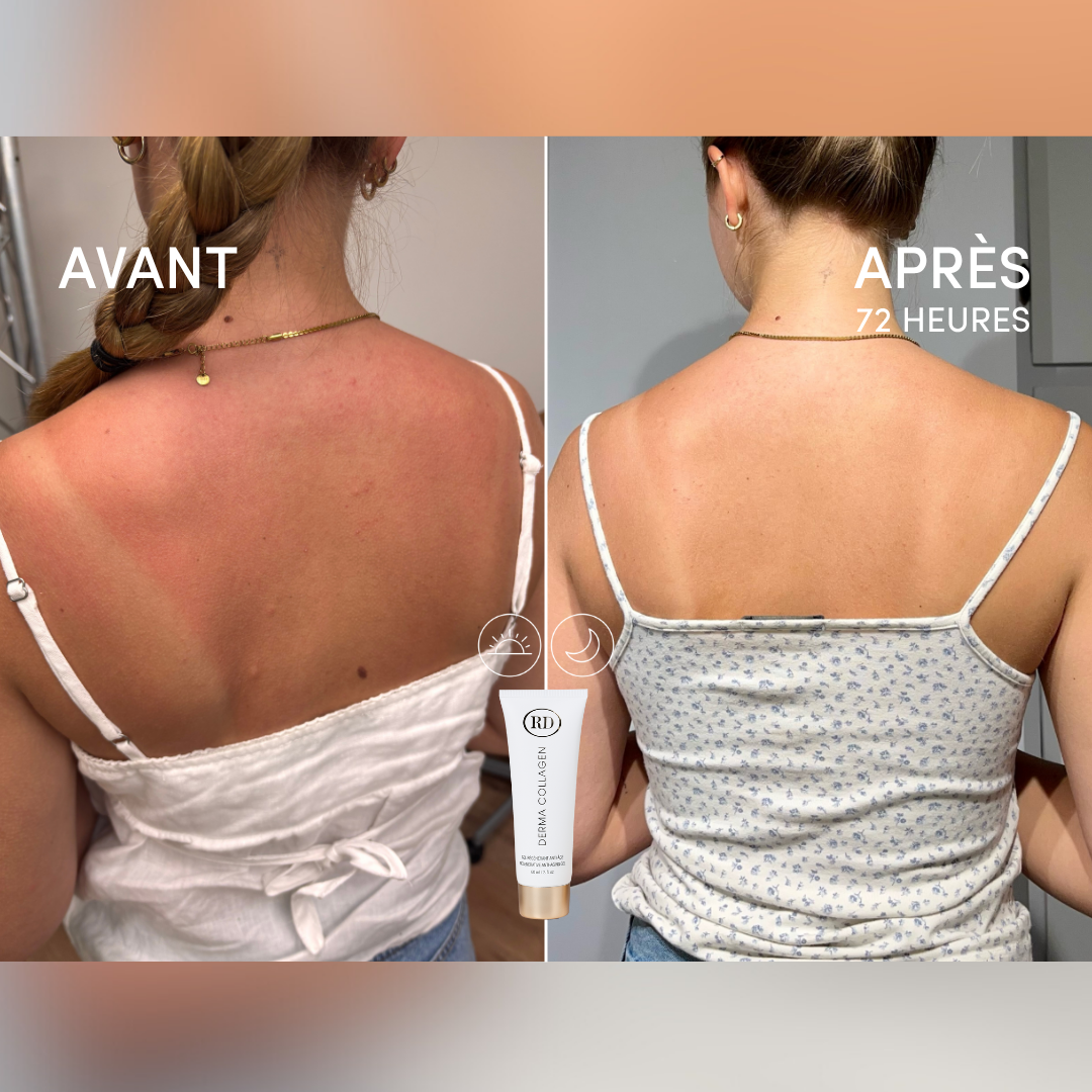 Gel Régénérant Anti-Âge Derma collagen 156ml | RD Cosmetic