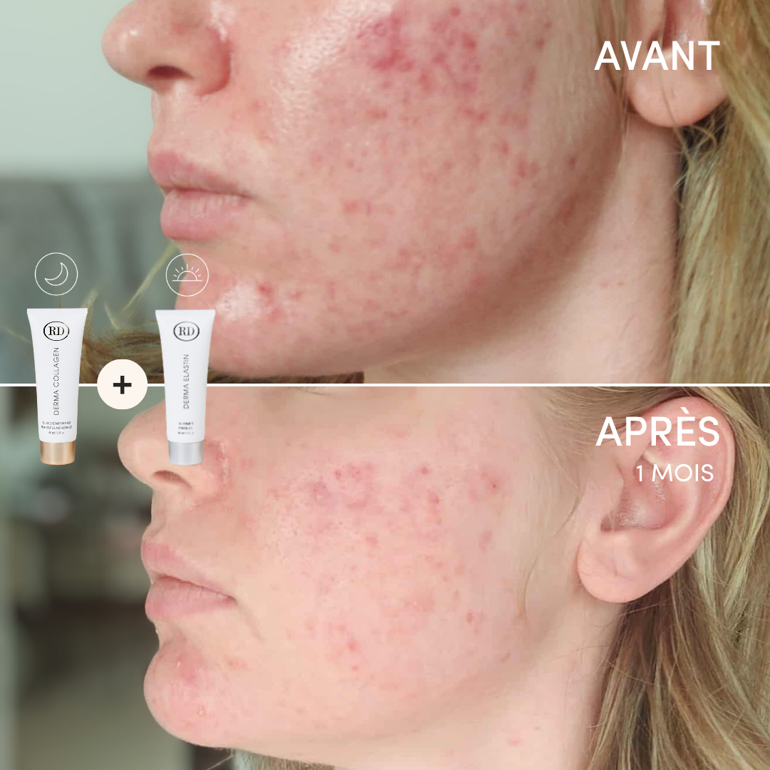 Duo Gel Régénérant Anti-Âge Derma Collagen et Gel Fermeté Derma Elastin 60ml | RD Cosmetic
