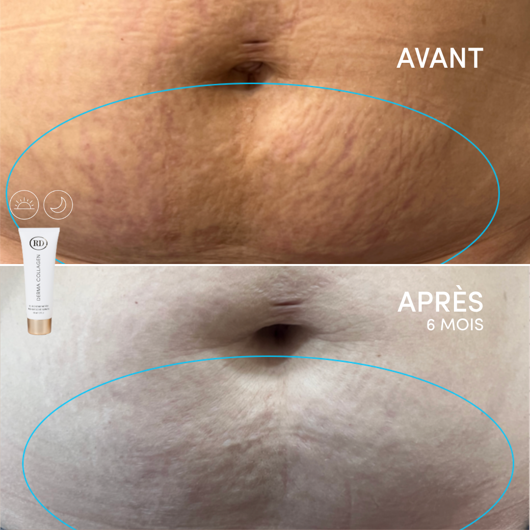Gel Régénérant Anti-Âge Derma collagen 156ml | RD Cosmetic