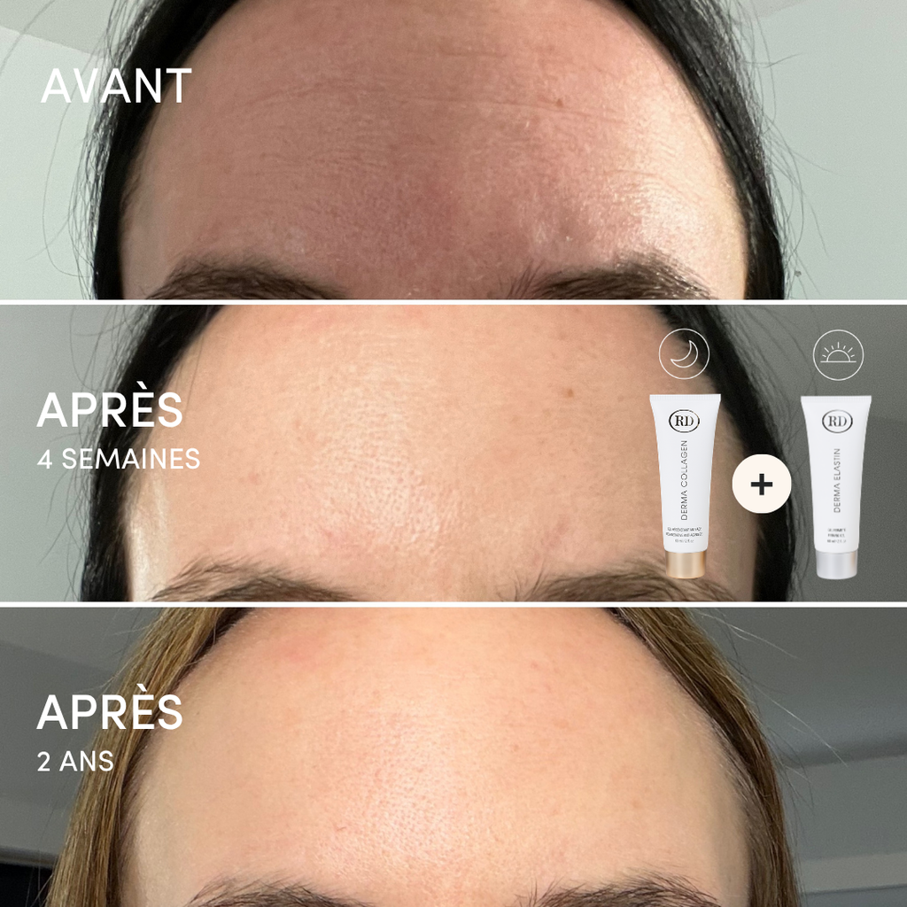 Gel Fermeté Derma Elastin 60ml | RD Cosmetic