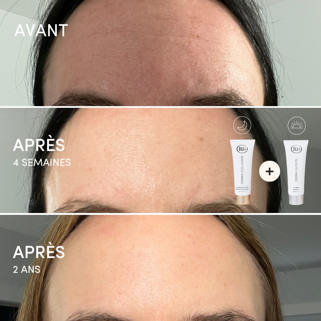 Duo Gel Régénérant Anti-Âge Derma Collagen et Gel Fermeté Derma Elastin 60ml | RD Cosmetic